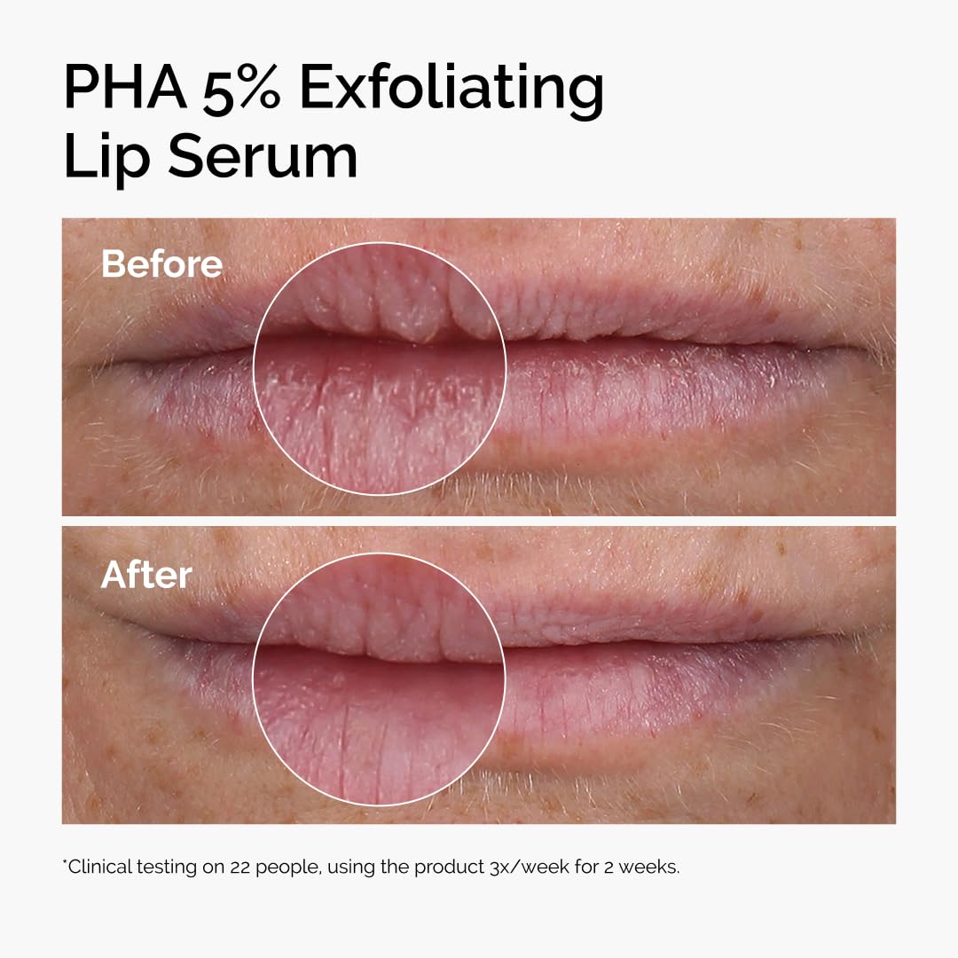 The Ordinary Lip Care Duo - Skin Care Bundle Set - PHA 5% Exfoliating Lip Serum 0.5 Fl Oz + Squalane and Amino Acids Lip Balm