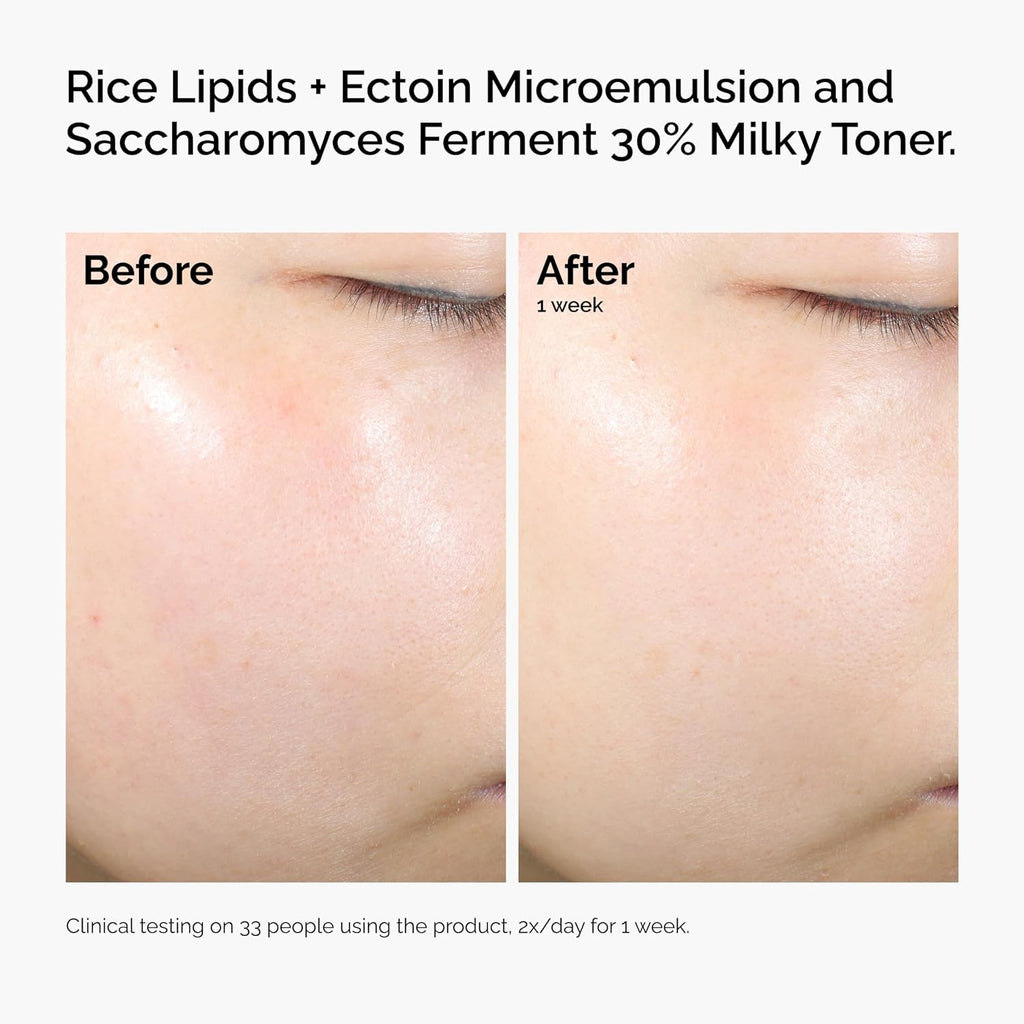 The Ordinary Rice Lipids + Ectoin Microemulsion Moisturizer for Dry Skin, Soothing Hydration, Barrier Repair, Reduced Redness