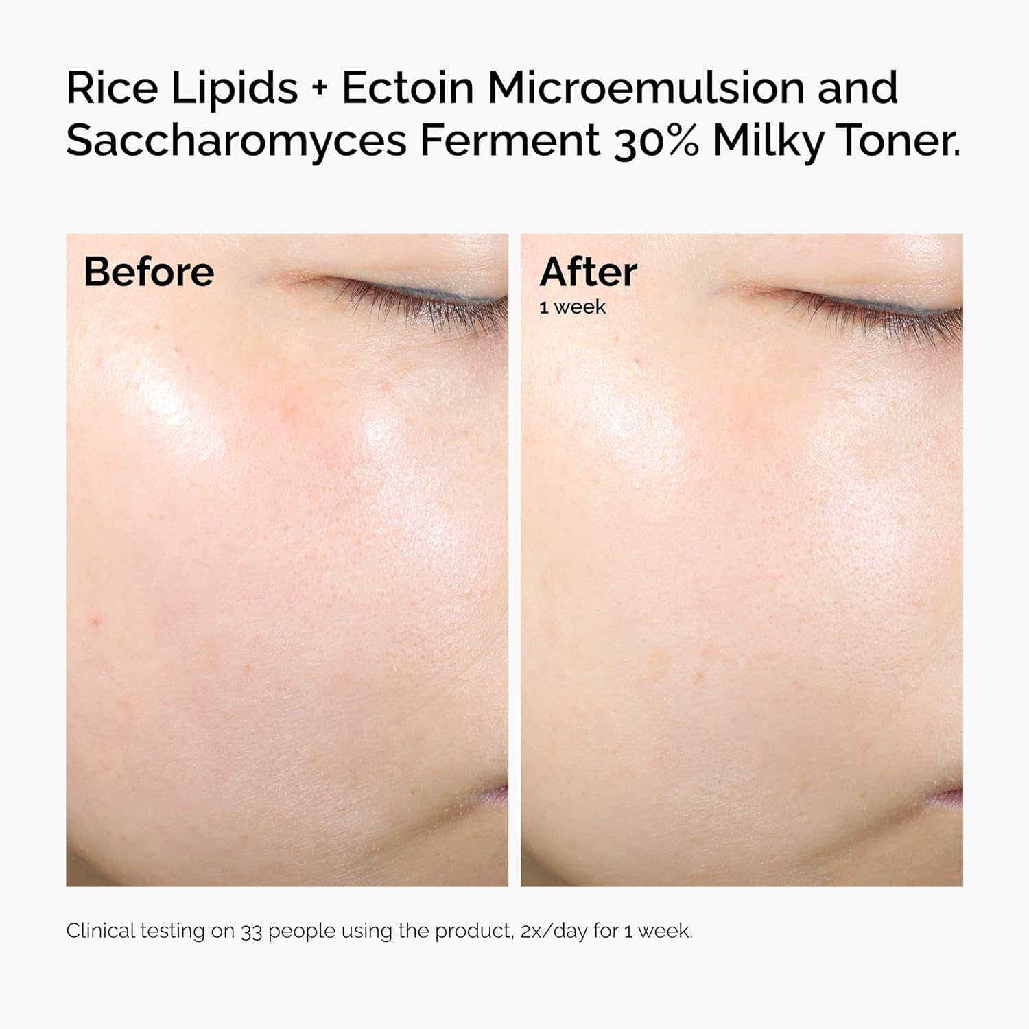 The Ordinary Rice Lipids + Ectoin Microemulsion Moisturizer for Dry Skin, Soothing Hydration, Barrier Repair, Reduced Redness