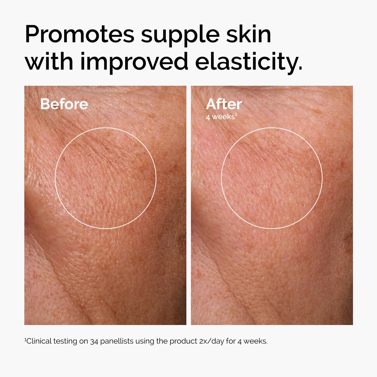 The Ordinary The Mini Icons Set, Travel Size Skin Care to Hydrate and Brighten, Glycolic Acid 7% Exfoliating Toner, Niacinamide 10% + Zinc 1%, Hyaluronic Acid 2% + B5, 4 Reusable Rounds