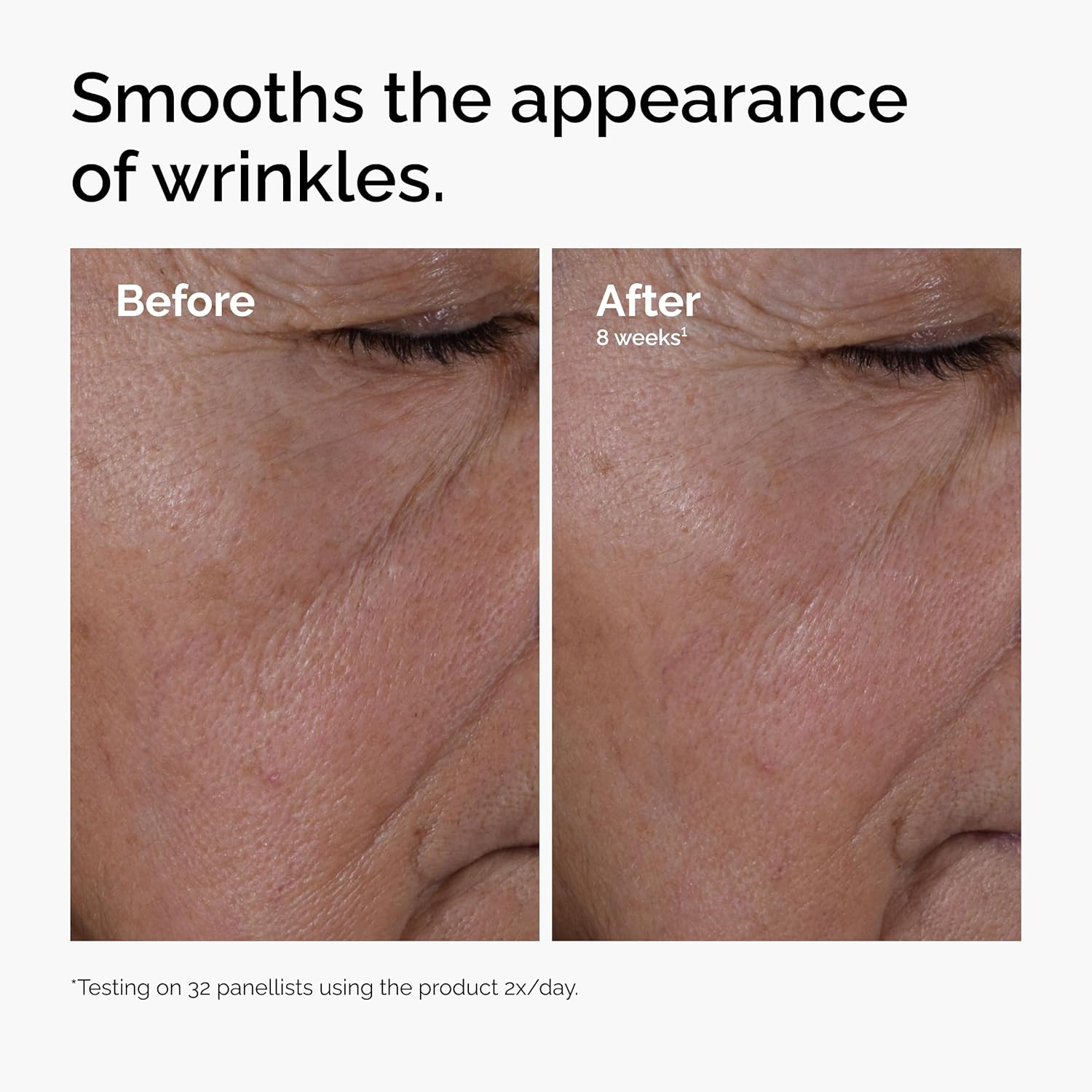 The Ordinary Multi-Peptide + Hyaluronic Acid, Anti-Aging Peptide Serum for Crow’s Feet, Elasticity & Firmness, 1 Fl Oz
