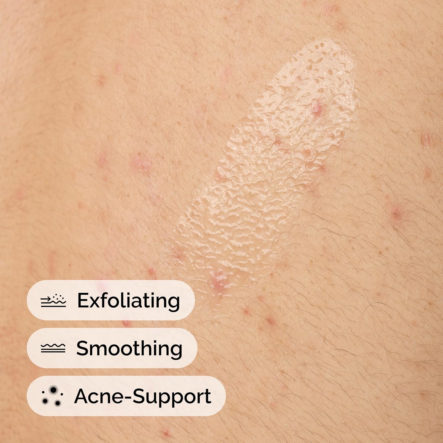 The Ordinary Salicylic Acid 0.5% Body Serum, Exfoliating Treatment for Acne-Prone Skin, 8.1 Fl Oz